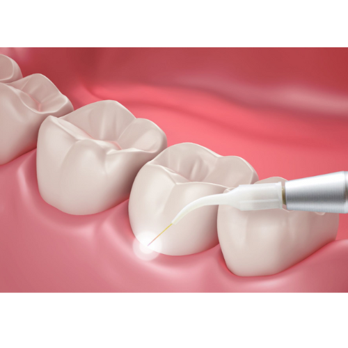 chirurgija ir periodontologija